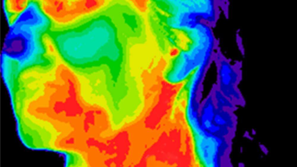 Hipertermia regional: ¿qué temperaturas se alcanzan realmente en los tejidos profundos del organismo?
