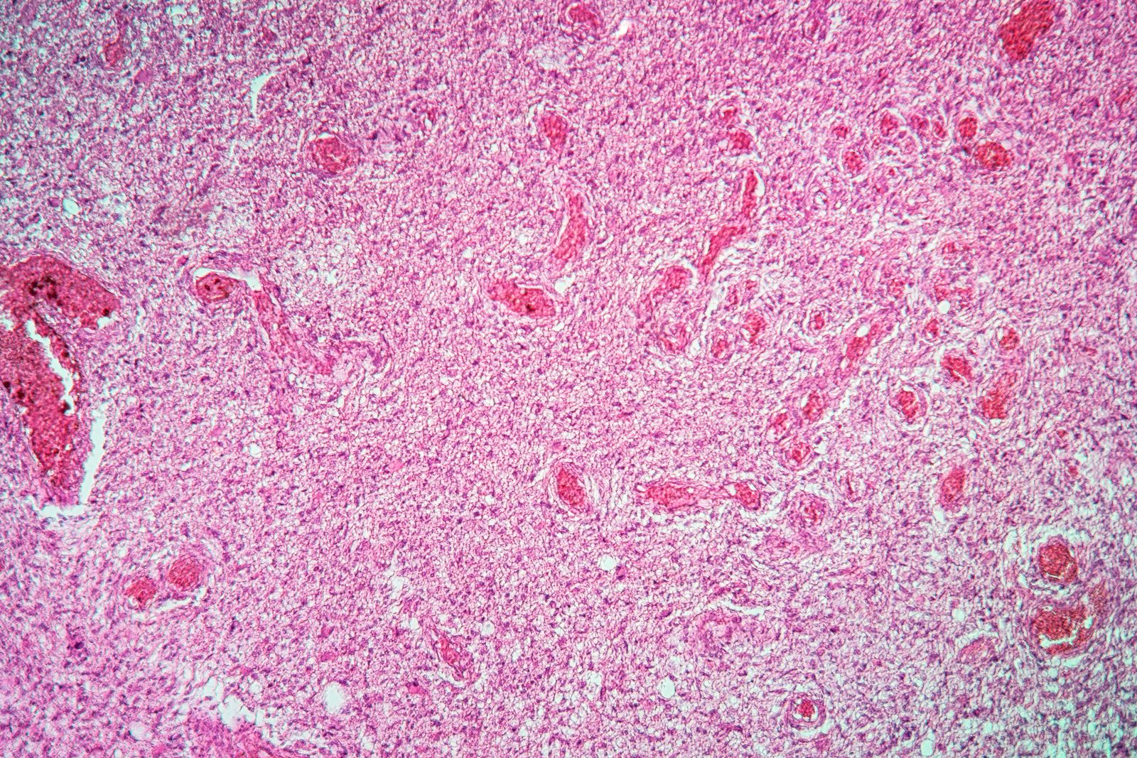 celsius42-gmbh-hyperthermia-and-radiation-induced-mr-diffusion